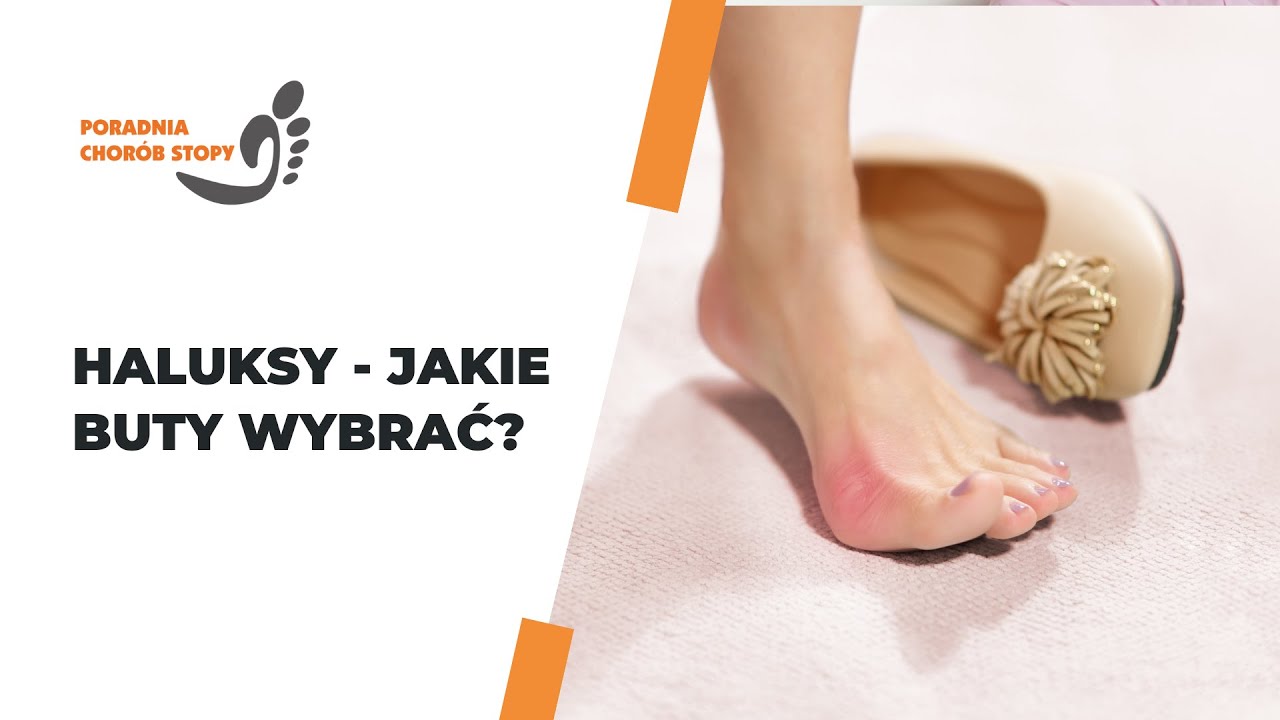 Haluksy - jakie buty wybrać
