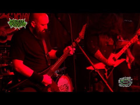 Skeletal Remains live from Ralphs Rock Diner 10/4/2024 (FULL SET)