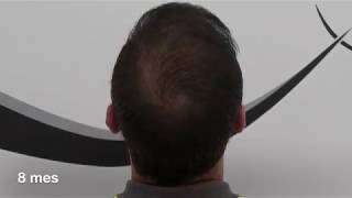 3000fu Zone A,B,C TÉCNICA FUE