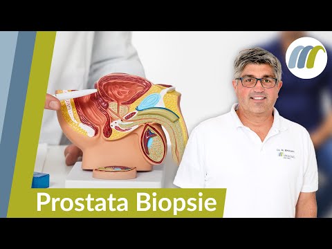 Prostata Krebs sicher feststellen: So funktioniert die Prostatastanzbiopsie