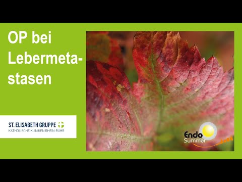 Endosummer 2021 – Minimal-invasive Chirurgie der Lebermetastasen