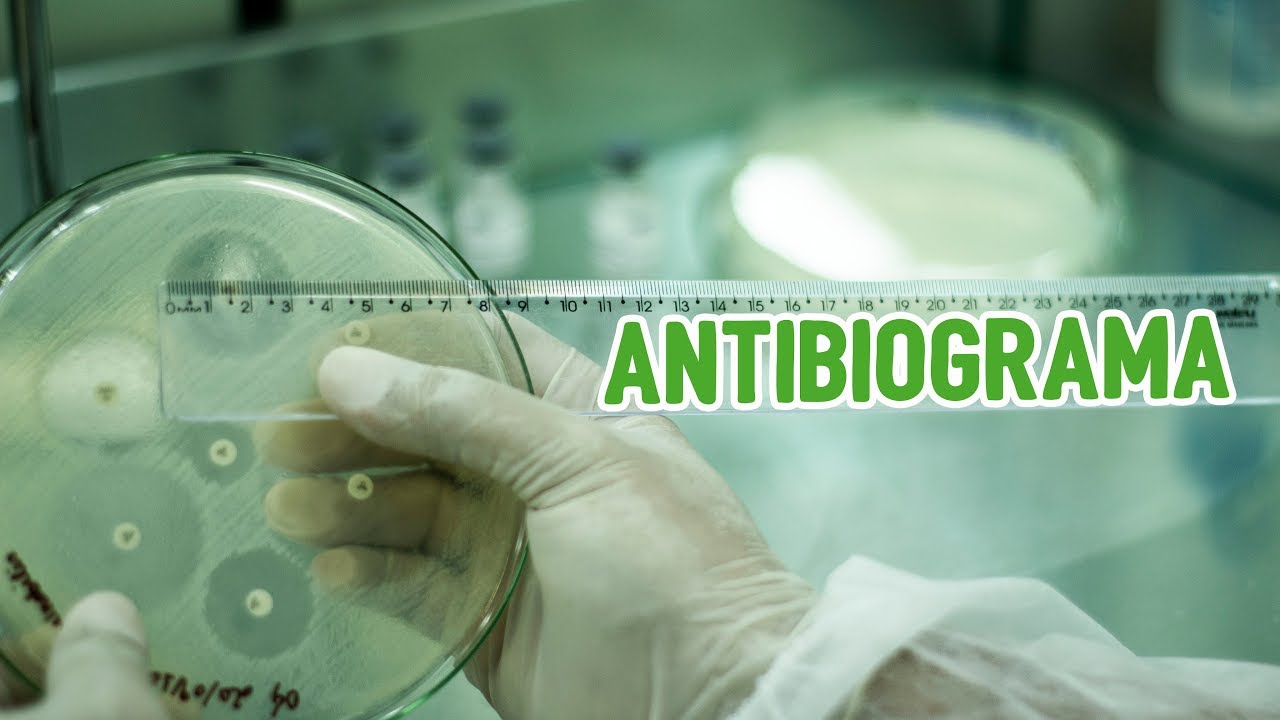 Como fazer e interpretar o Antibiograma?