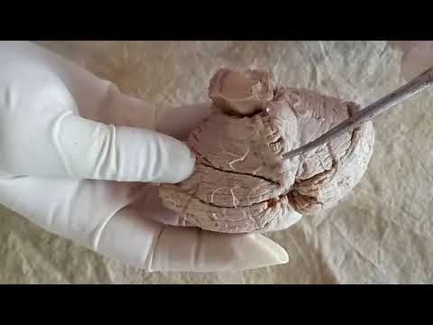 NEUROANATOMY - CEREBELLUM EXTERNAL FEATURES - BY DR MITESH DAVE