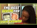 The BEST Onion Juice Recipe For Maximum HAIR GROWTH