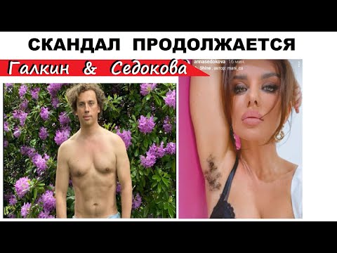 СКАНДАЛ СЕДОКОВА И ГАЛКИН ПРОДОЛЖАЕТСЯ АННА ПРОТРОЛИЛА И ШОКИРОВАЛА ПУБЛИКУ
