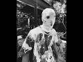YFG Fatso Sample Type Beat X Chuckyy Type Beat Fallin