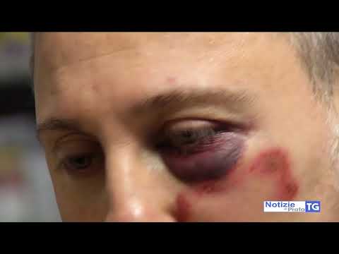 2018-02-06 PRATO - RAPINA IN TABACCHERIA, PARLA IL TITOLARE PICCHIATO