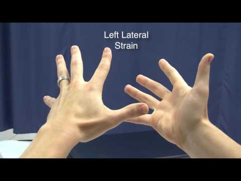 cranial strains hand motions