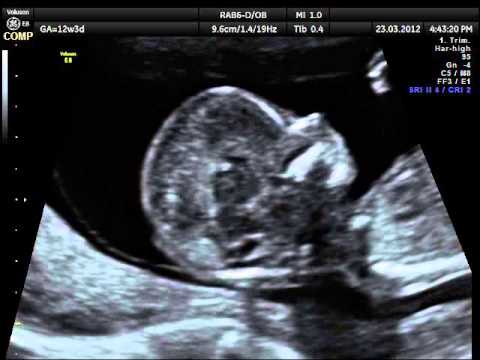 Supposte rettali da dolori articolari Il dolore della colonna vertebrale cervicale fisioterapia