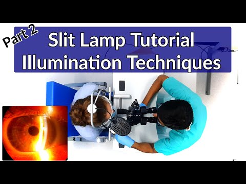 Slit Lamp Exam Tutorial - Part 2 | Illumination Techniques