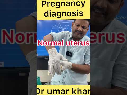 Pregnancy diagnosis l dr umar khan
