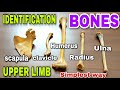 Upper limb bones ll identification ll side determination || anatomy of upper limb || bones ||