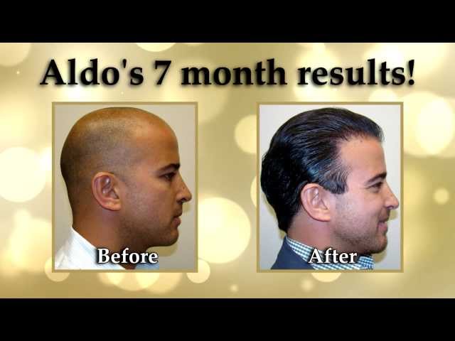 Aldo's Timeline