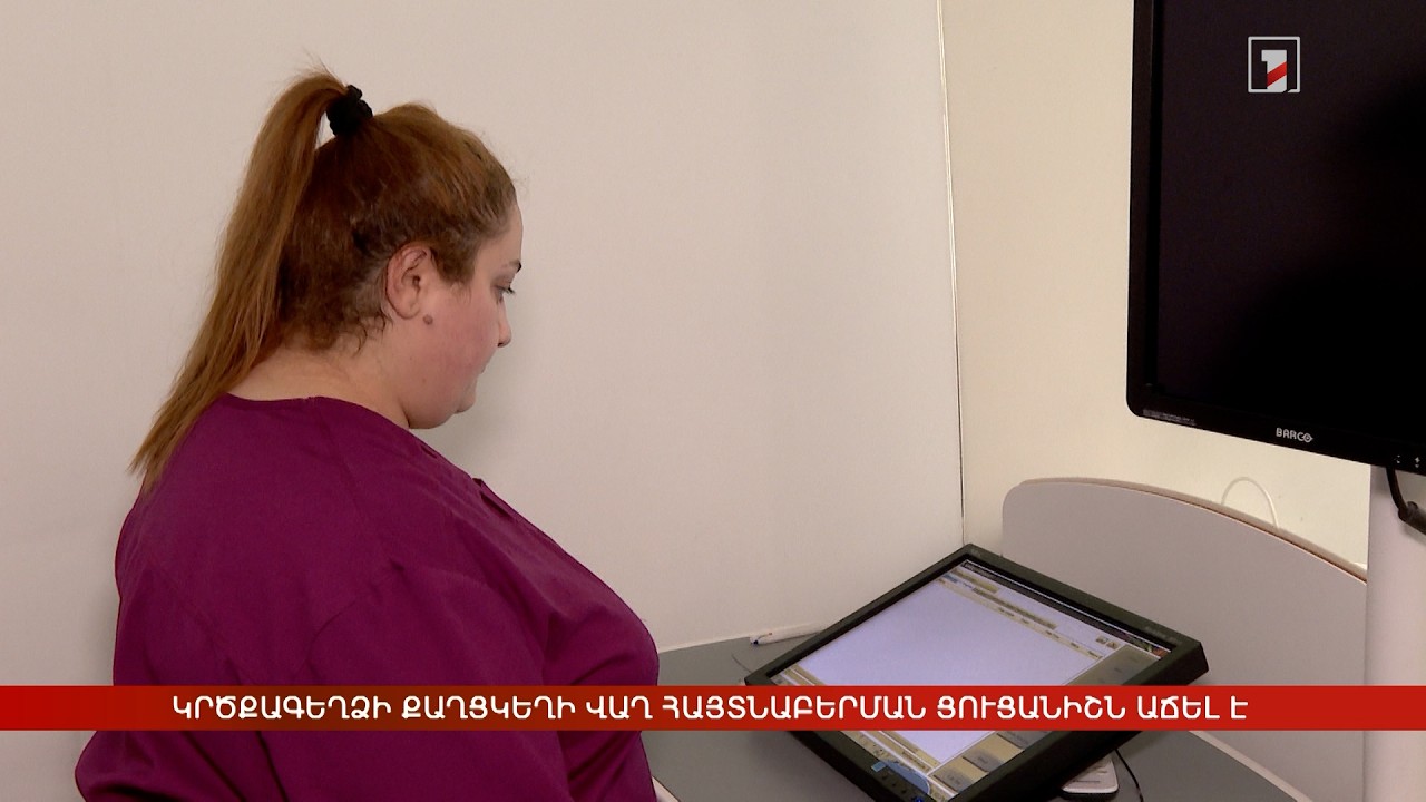 Կրծքագեղձի քաղցկեղի վաղ հայտնաբերման ցուցանիշն աճել է