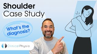 Shoulder Pain Case Study | Specialist Physio explains Symptoms, Diagnosis and Clinical Reasoning!