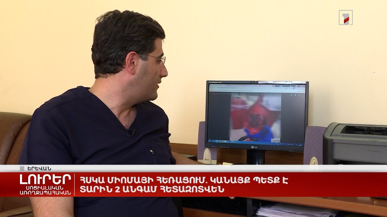 Հսկա միոմայի հեռացում. կանայք պետք է տարին 2 անգամ հետազոտվեն