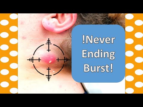 download lagu mp3 mp4 Popper, download mp3 Popper free download, download mp3 Popper