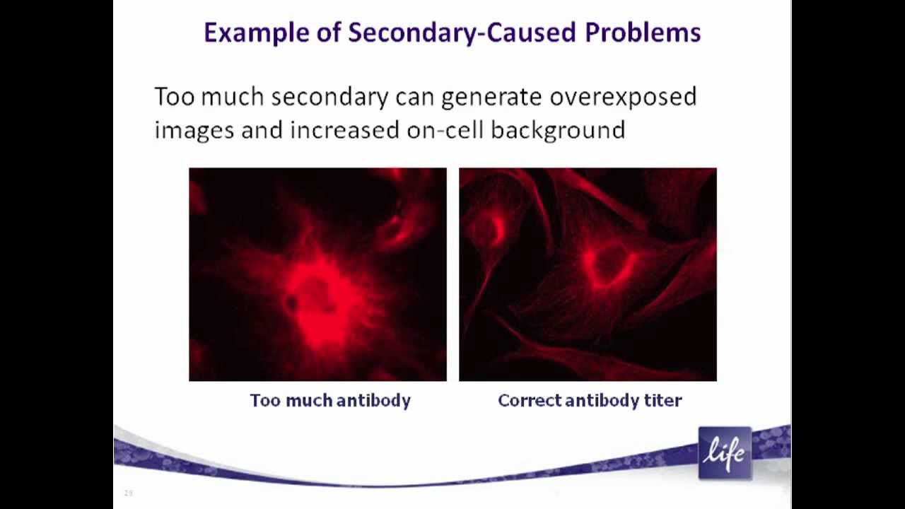 An intro to immunofluorscent staining of cultured cells, webinar preview
