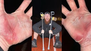 Running a MARATHON on Crutches