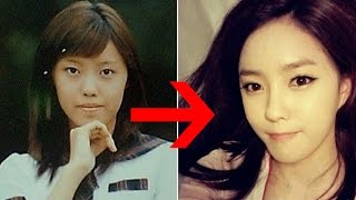 15 Korean Celebrities That Admitted Having Cosmetic Enhancements