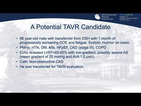 Sorting out AS and its impact on the myocardium_Cavalcante_Structural On Demand
