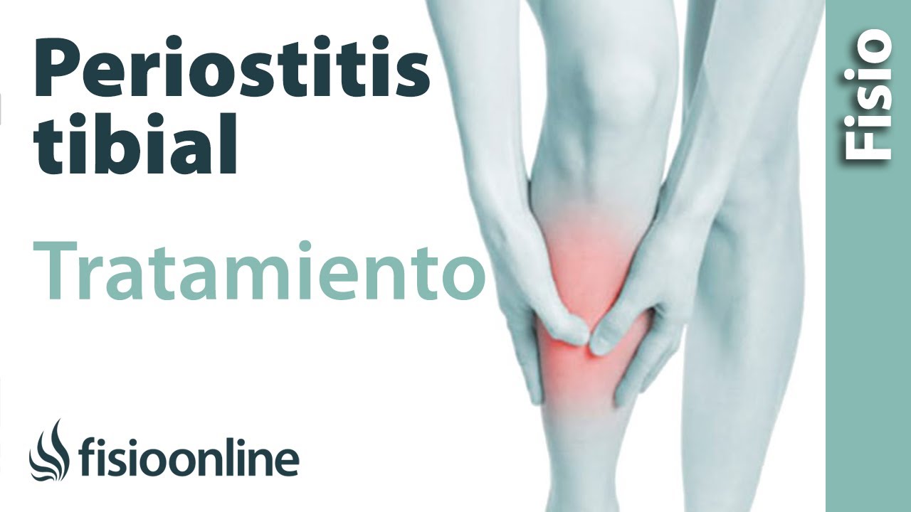 Watch Periostitis tibial - Qué es, causas y tratamiento Now Periostitis tibial - Qué es, causas y tratamiento