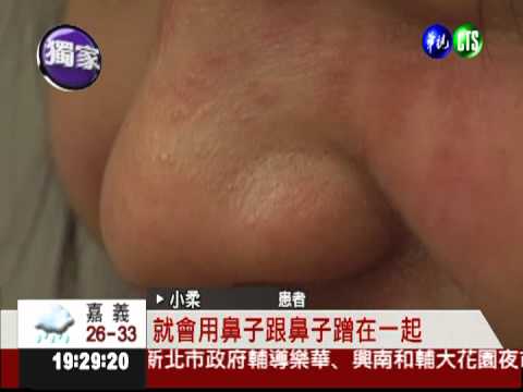 和刺蝟玩親親 少女長黴臉紅腫