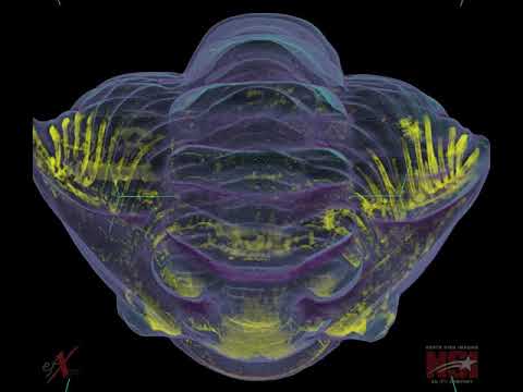 X-ray CT of trilobite rolled into a ball