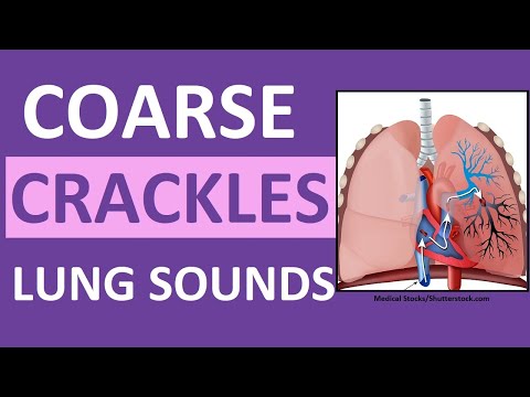 Crackles (Coarse) Lung Sounds | Crackles and Rales Breath Sounds Abnormal