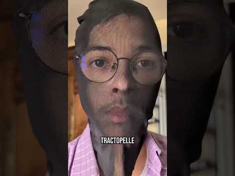 C’est pas passé loin
