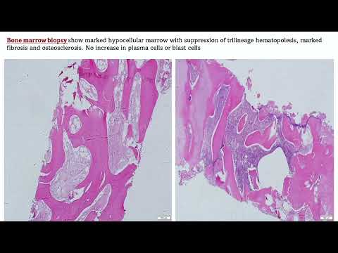 Challenging cases (Myeloid neoplasms) – Dr. Heba Raslan (September 15-16, 2023)
