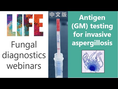 Aspergillus antigen (galactomannan) - fungal diagnostics webinar (with Q&A) invasive aspergillosis - YouTube