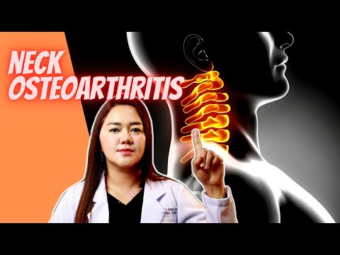 Is Neck Pain (Cervical Spondylosis) Dangerous? (UPDATED!) | Doc Cherry