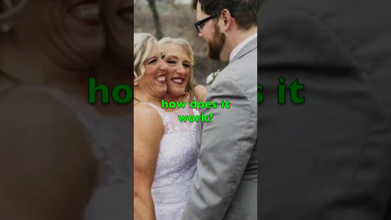 Conjoined Twins Answer Burning Questions!#conjoinedtwins #shorts #abbyhensel