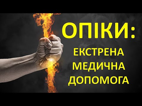 ОПІКИ (Опіковий Шок, Опікова Хвороба): Види, Ступені, Медична допомога та часті помилки