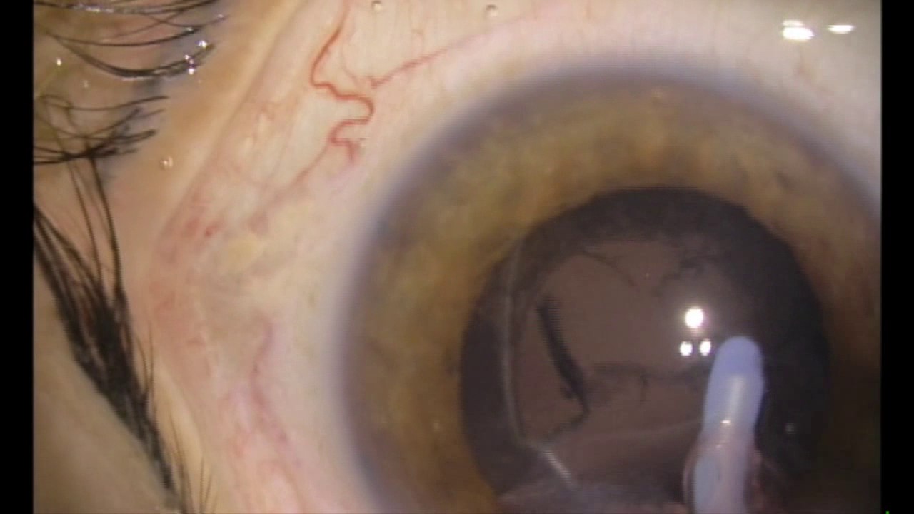 Rafael Castañeda Diez-22