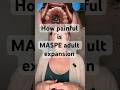 How Painful Is MASPE Adult Expansion Appliance Smallmouth Marpe Maspe