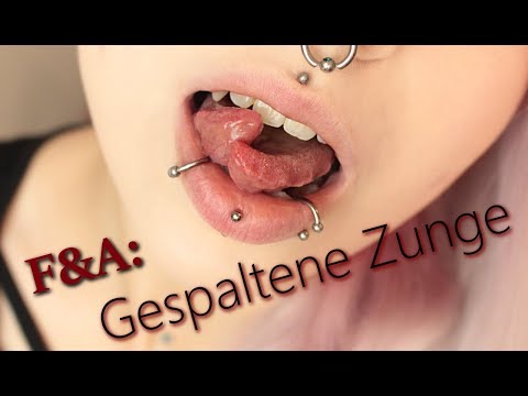 Moknuschtschaja das Ekzem auf den Füssen des Fotos Die feingewebliche Forschung beim Ekzem
