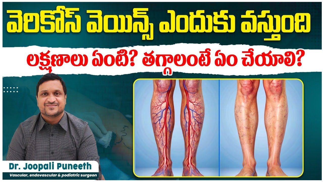 Kidney Stone Pain Explained