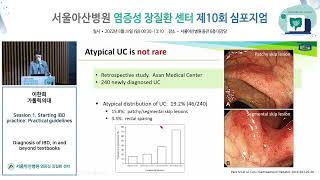 Diagnosis of IBD, in and beyond textbooks 썸네일