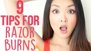 HOW TO: Prevent and Get Rid Of Razor Burns!