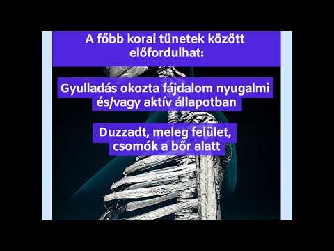 Ízületi osteodystrophia kezelés