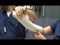 Ulnar Gutter Splint