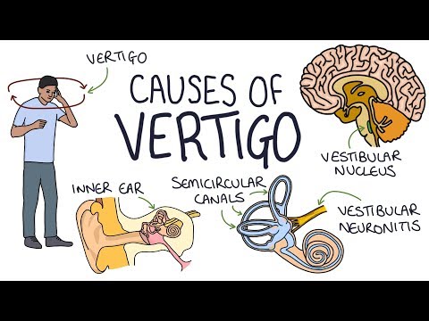 Understanding the Causes of Vertigo