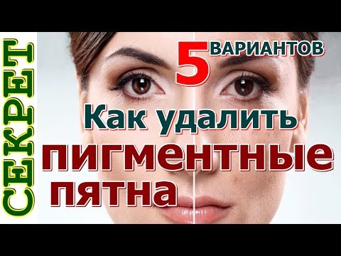 Пигментные пятна на лице после операции Пигментные пятна чешутся и увеличиваются
