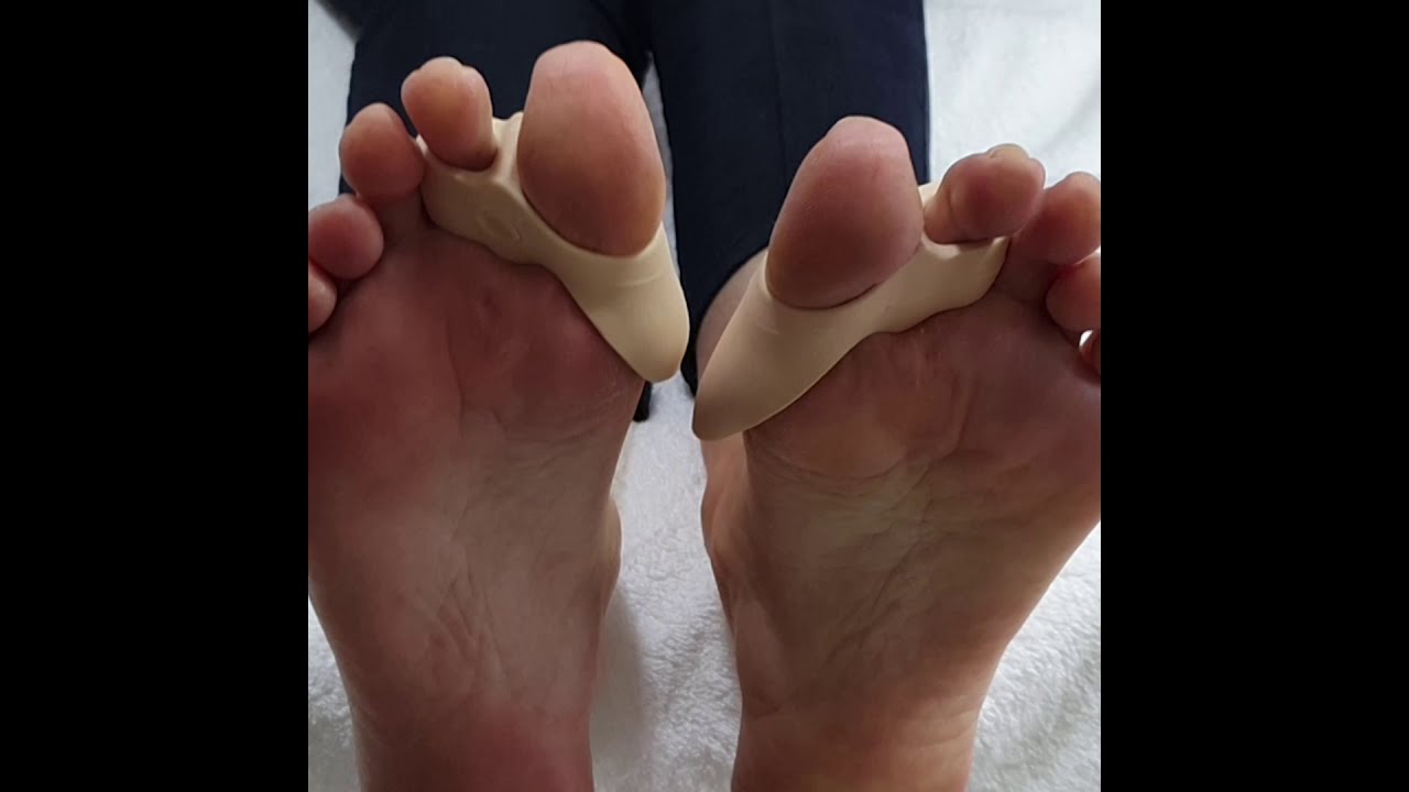 Pedisil Zilver Teenspreider Hallux Valgus en Bunion Beschermer (RPSIL6 0003) - by Rodiq Footcare