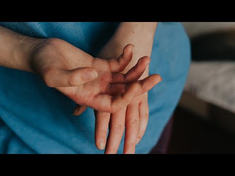 api nap a helmintektől paraziták jelenléte vélemények