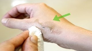 How To Remove Dye From Skin - Using Home Remedies.