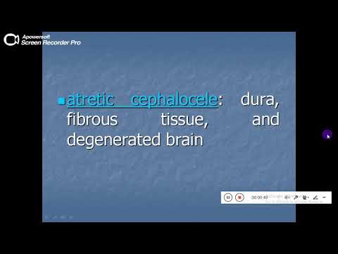 Quiz powerpoint video - Case 171- Refresh your knowledge