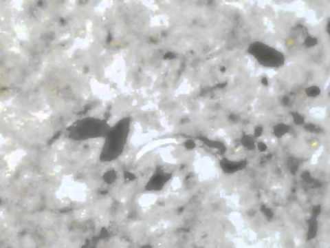 Lo stomaco un verme è aumentato I vermi che provocano la dermatite